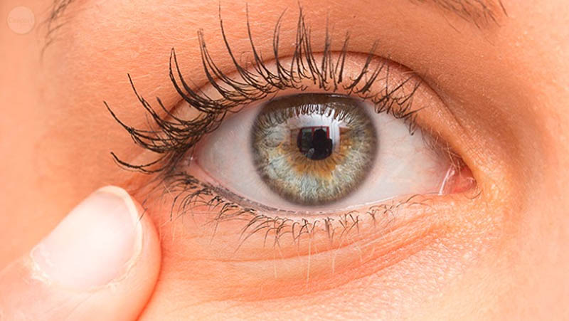 Rigetto nei trapianti di cornea dopo la vac.cin.azione COVIDdiciannove